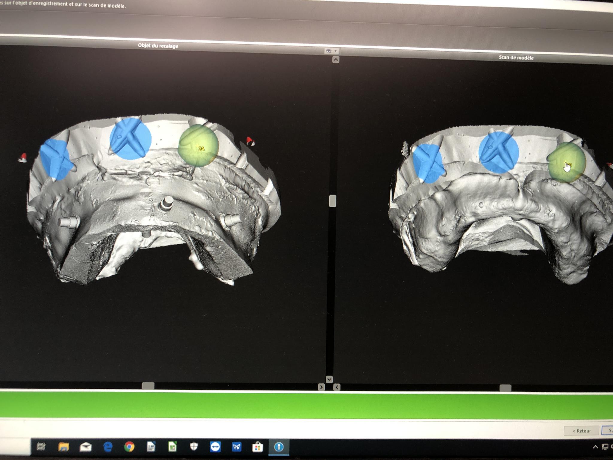 Reconstruction Sur Implants Chrome Labor Srl